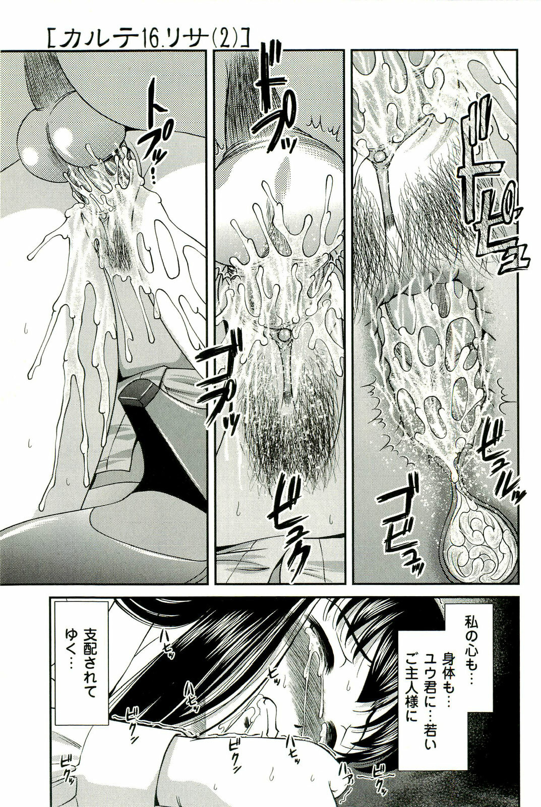 [SHION] Seikan Chiryou ～ Kuroyume Karte 2 ～ page 162 full